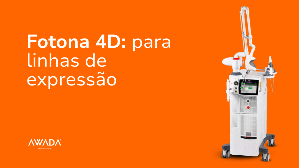 Tratamento facial com Fotona 4D em região do rosto para suavizar linhas de expressão